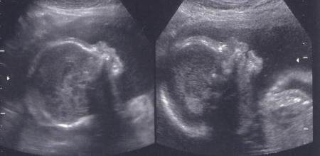 ...et voici notre petit enfant